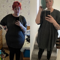 Contemplating bariatric surgery.... advice?