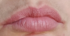 To think you can’t/tell if these lips have fillers? Photo attached