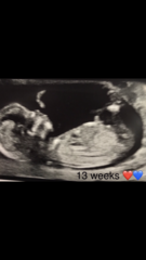 Boy or girl guesses? Scan pics attached