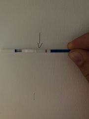 How long after MC did you have negative tests?