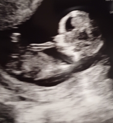 Gender Scan next week