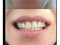 Cosmetic dentist recommendations - North West