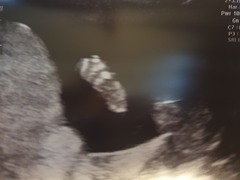 👣 Due late Nov/Dec, it's bump time ladies! 👣