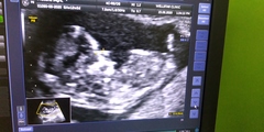 Baby gender guess at 12 weeks