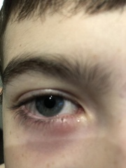 What’s wrong with ds’ eye? (With pics)