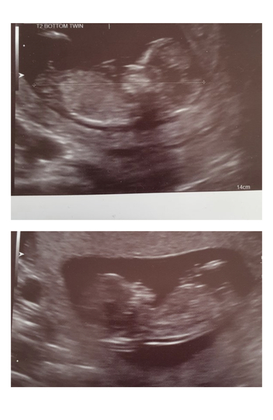 TTC after MC - July 2020 (Thread 7)