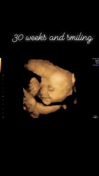 Pregnant After Loss and Dreaming of Rainbows - 4