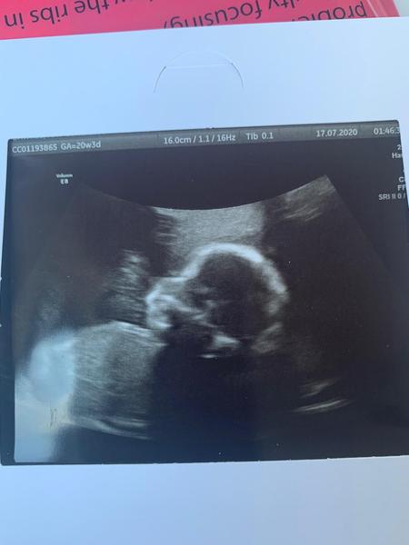 👣 Due Nov/Dec 👣 it's the 20 week scans! 👣