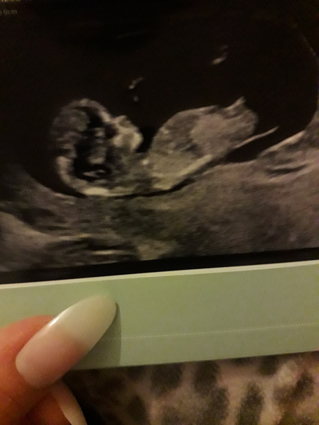 Baby's gender