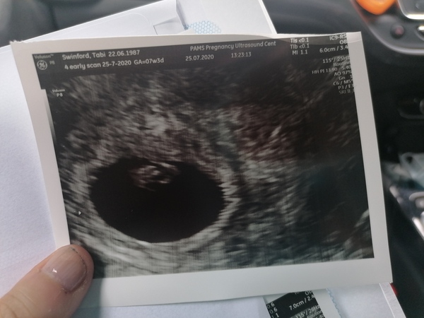 March 2021 babies