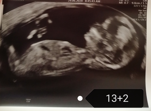 Gender guesses