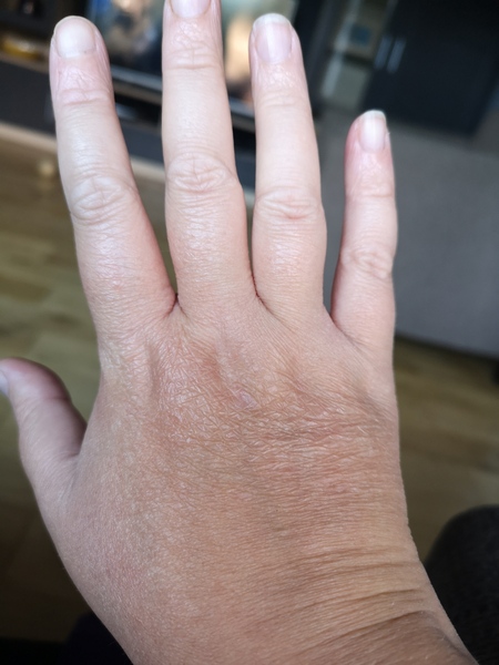 Why are my hands ageing so quickly?