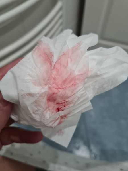 TTC after MC - July 2020 (Thread 7)