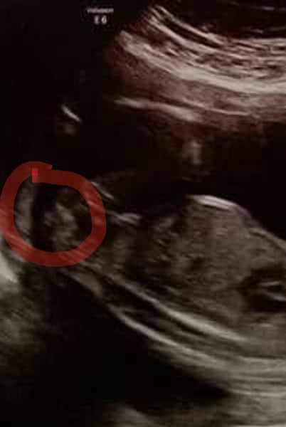 The May Group Graduates. RING HOOP BULLET.