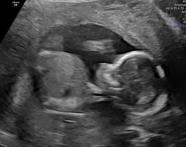 Christmas babies thread 4!