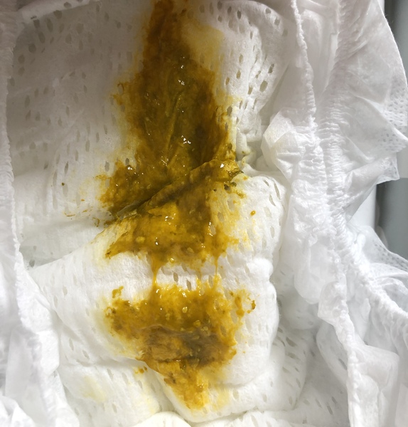 Is this cows milk allergy?