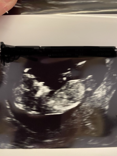 Gender guess!