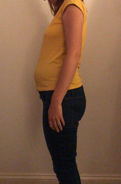 👣 Due Nov/Dec 👣 it's the 20 week scans! 👣