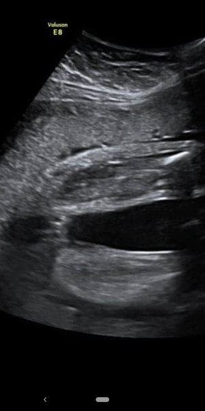 Girl or boy? Potty shot
