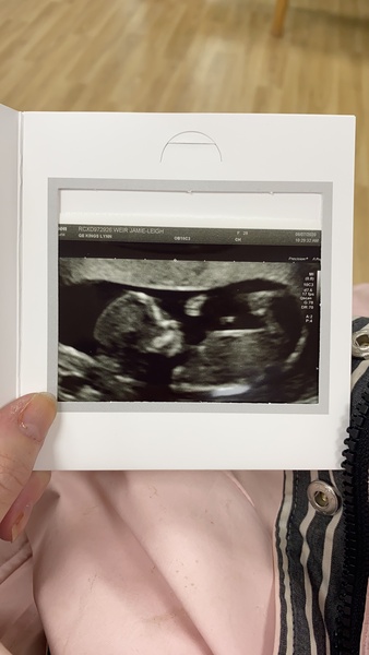 Gender guess!