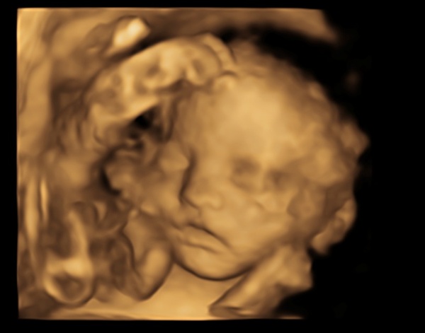 Early Oct Babies Part 6