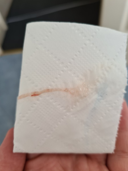 TTC after MC - July 2020 (Thread 7)