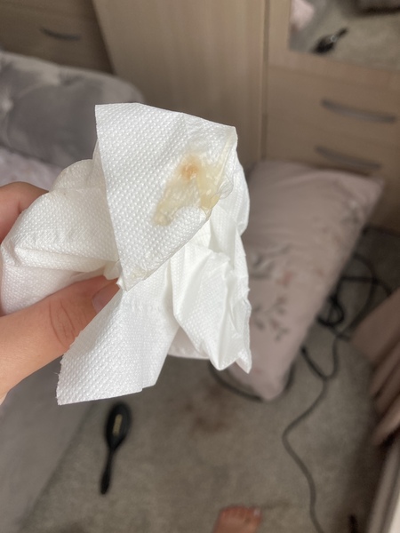 Mucus plug? Warning graphic pic