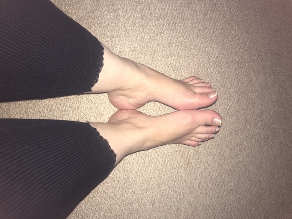 Swollen ankles (not pregnant)