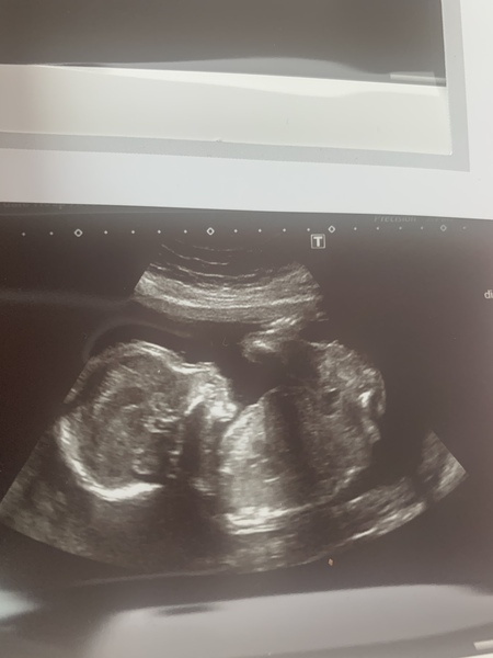 👣 Due late Nov/Dec, it's bump time ladies! 👣