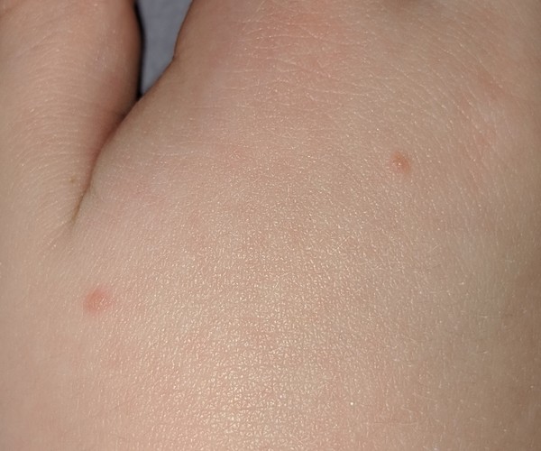 To ask what these lumps look like to you?
