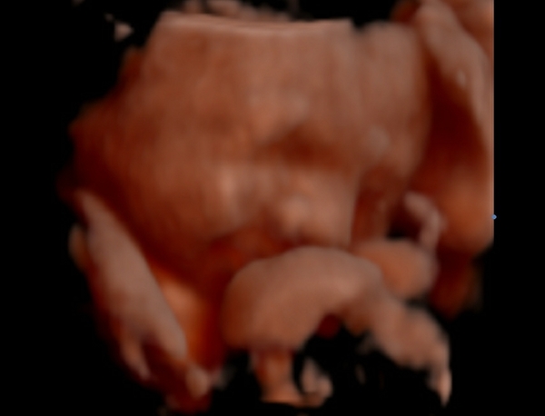 Early Oct Babies Part 7