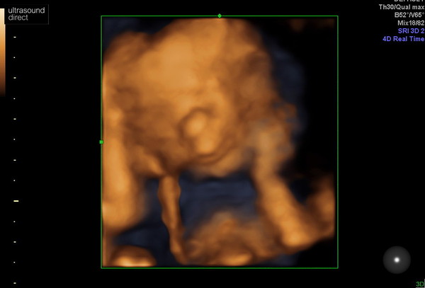 👣 Due Nov/Dec 👣 it's the 20 week scans! 👣