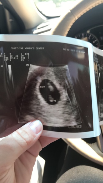 Yolk sac