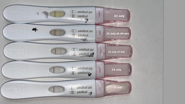 Pregnant after Missed Miscarriage MMC