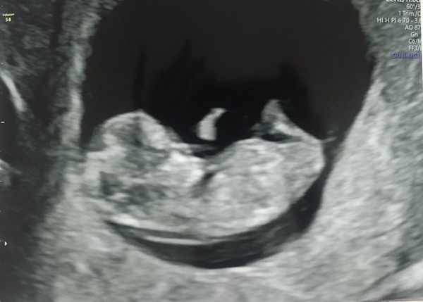 Jan/Feb 2021