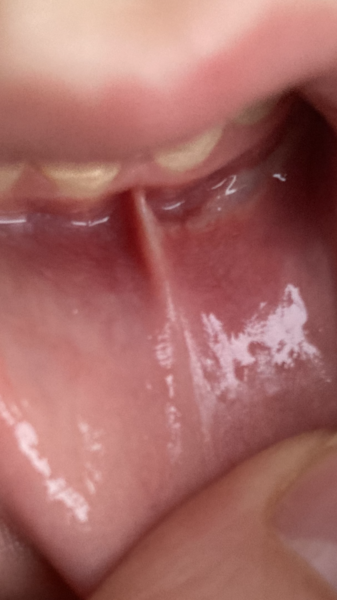 Any dentists please?