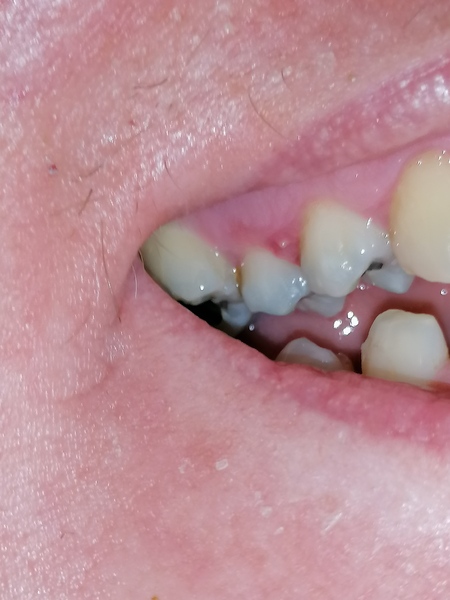 Is this a dental infection?
