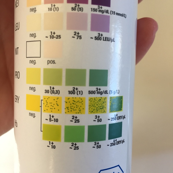 + protein in urine