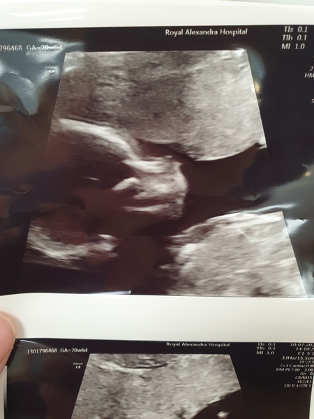Thread 2 for us classed as more mature pregnant ladies