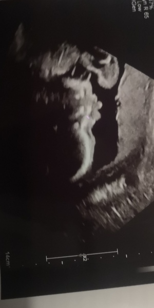 Pregnant After Loss and Dreaming of Rainbows - 4