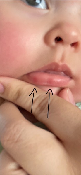 Dots on lip? What is this?