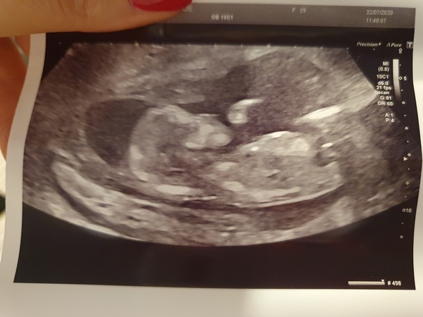 January 2021 due date bus 4