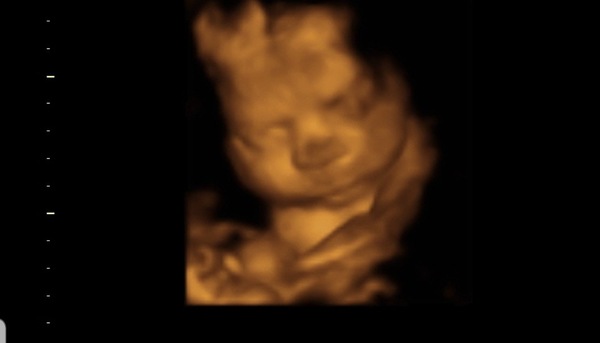 Early Oct Babies Part 6