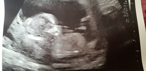 Fun gender guess ❤