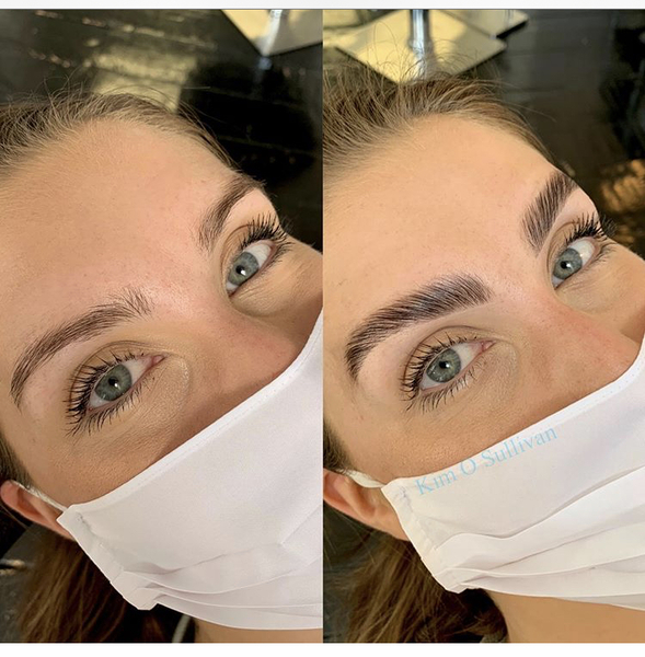 Microneedling or laminating? Please help me!