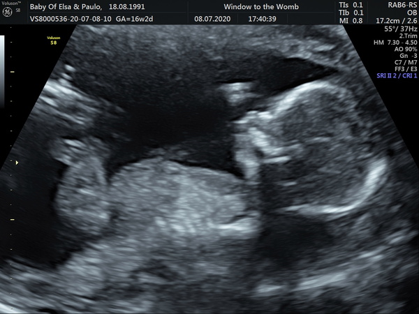 Christmas babies thread 4!
