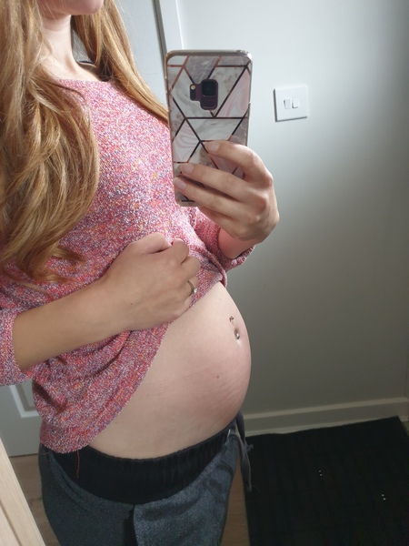 👣 Due Nov/Dec 👣 it's the 20 week scans! 👣