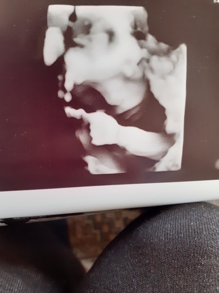 Pregnant after Loss and Dreaming of Rainbows - 5