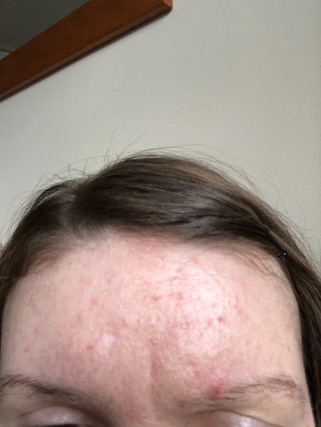 Please someone help with my skin!