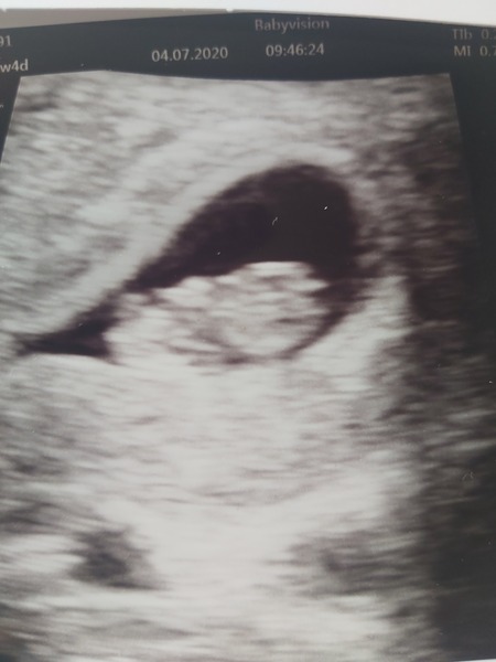 Any nub/ramzi/skull theory gender guesses?